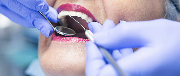 Best Walk-In Emergency Dental Services in Blaine, WA